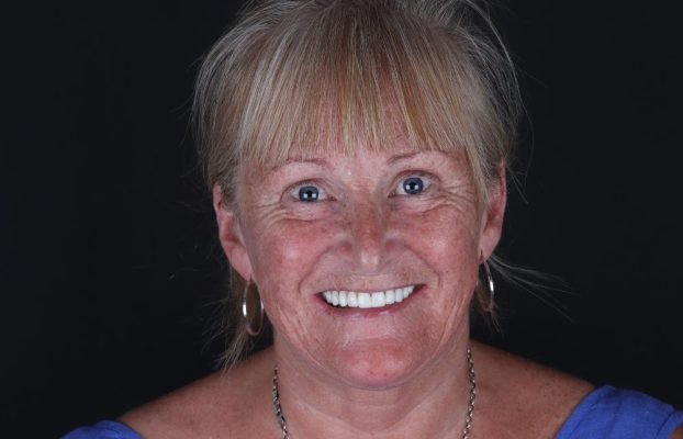 Dental Treatment in Antalya at AestheDental