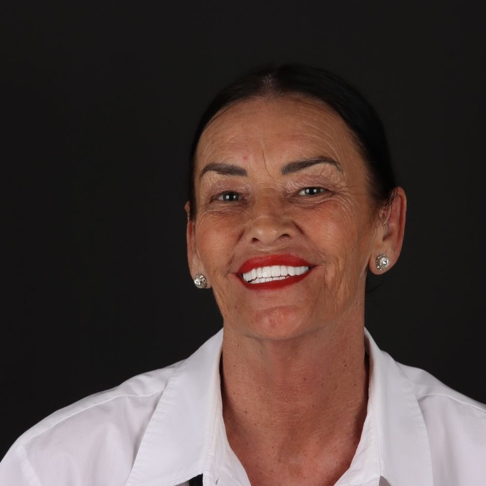 Unveiling the Magic: Aesthetic Smile Design at AestheDental