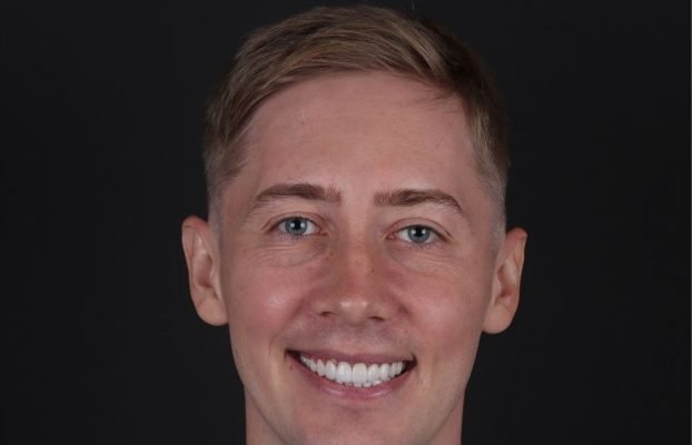 All on Four Treatment: The Antalya Experience for a Smiling – Aesthedental