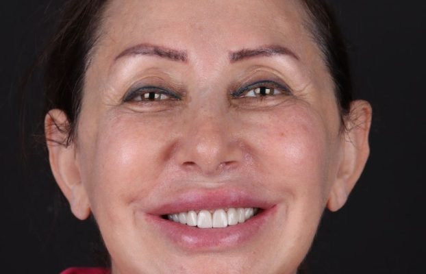 Reclaim Your Smile at Aesthedental