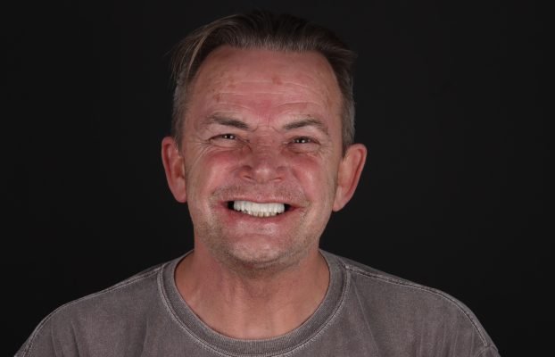 Unlock Your Perfect Smile with Aesthedental