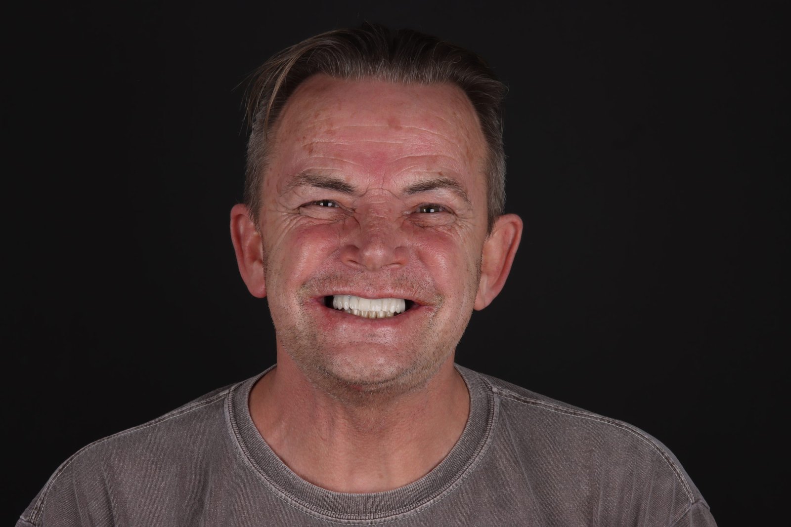 Unlock Your Perfect Smile with Aesthedental